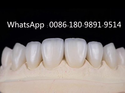 中国义齿实验室 假牙供应商 牙科生产厂家图3