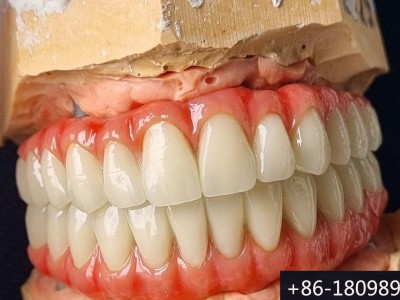 中国深圳牙齿修复工厂 义齿加工_假牙加工厂_二氧化锆烤瓷牙图2