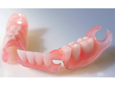 深圳活动修复义齿-定制式活动义齿 假牙厂家-义齿 假牙厂家图3