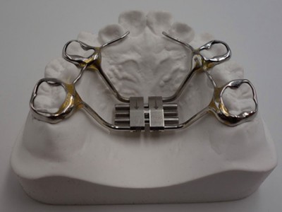 深圳义齿加工、牙齿保持器厂家-隐形矫正品牌图1