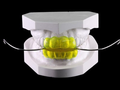 深圳义齿加工厂 固定义齿 3D 打印牙科矫正器出口图1