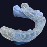 上海3D打印透明牙套 隐形牙套、隐形矫正出口