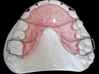 深圳义齿加工厂 固定义齿 3D 打印牙科矫正器外贸出口图1