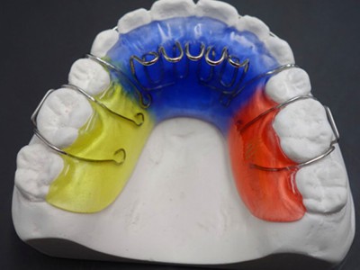 中国的透明牙套直接3D打印 隐形矫治器生产，隐形矫治方案设计图2