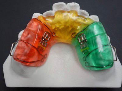 中国的透明牙套直接3D打印 隐形矫治器生产，隐形矫治方案设计图3