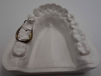 隐形口腔正畸矫治矫治器牙齿矫治器牙具矫治器图3