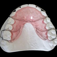 深圳专业做义齿加工厂 固定义齿 3D 打印牙科矫正器出口
